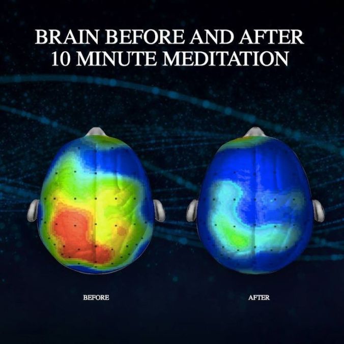 176518-The-Brain-Before-And-After-Meditation